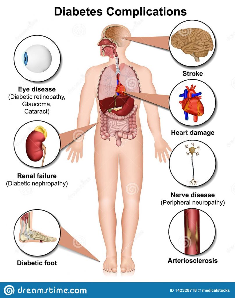 Diabetes Mellitus ​   Athma Hospitals, Trichy   Psychiatry   De ...