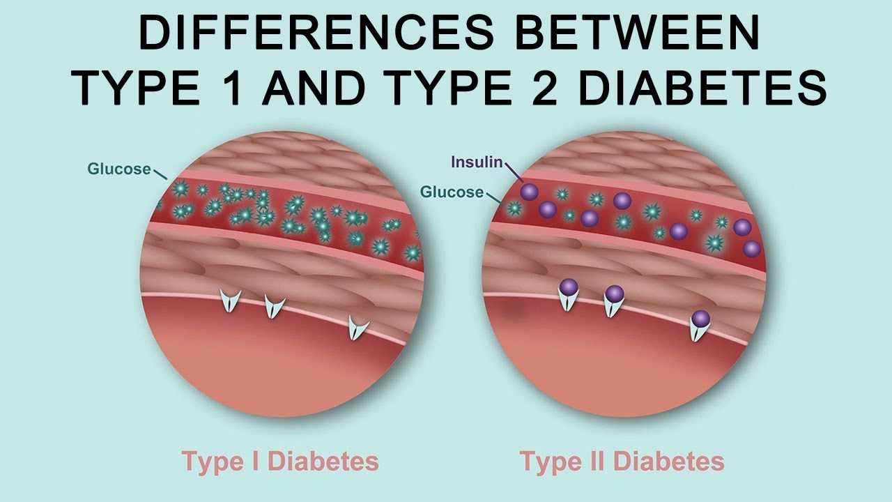 Diabetes Mellitus ​   Athma Hospitals, Trichy   Psychiatry   De ...