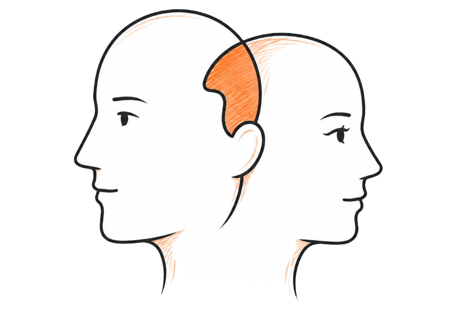 Personality Disorders